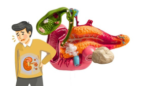 kidney-stones-or-gallstones.jpg