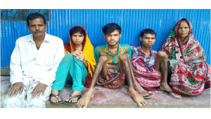 noakhali rare disease.jpg