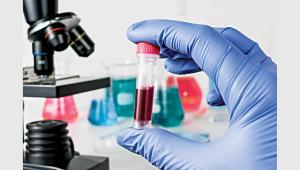 lab-tests-disease-diagnosis.jpg