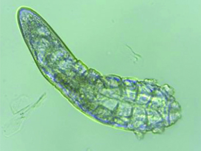mites.jpg