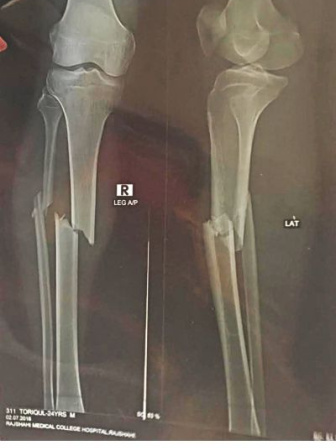 BCL leader attack on quota reformists